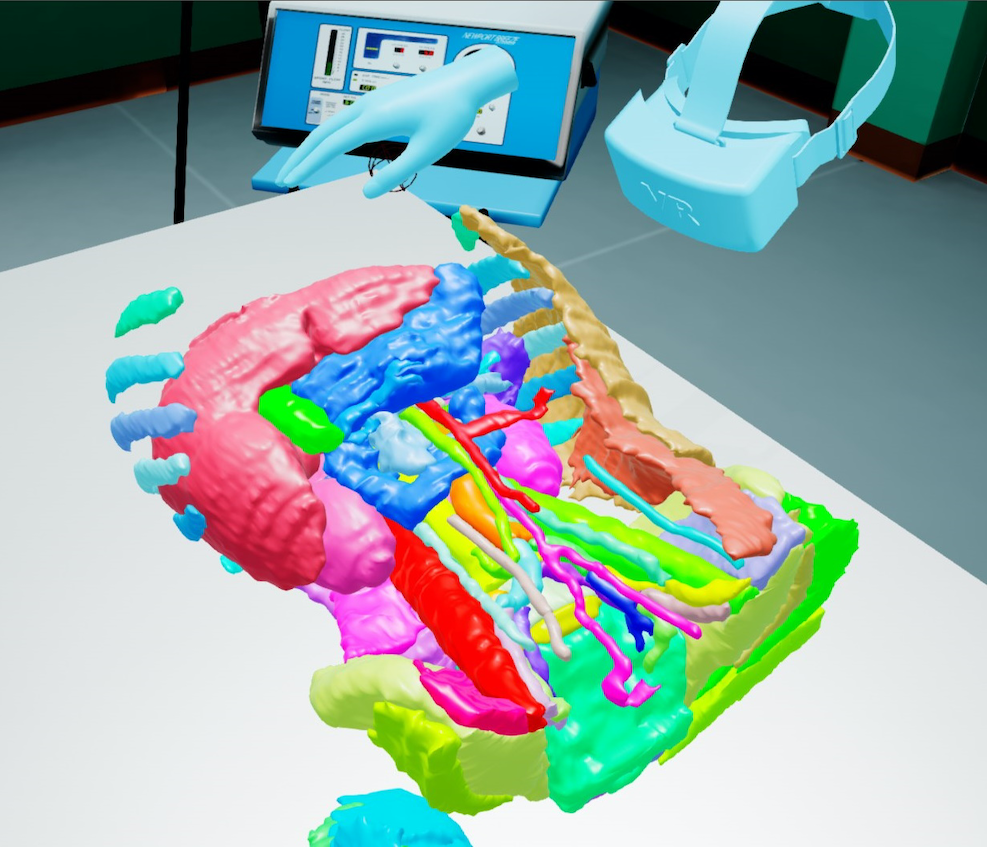 The SPL abdominal atlas view