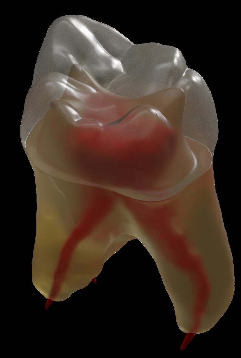 Dentin shape extruding towards the cusps