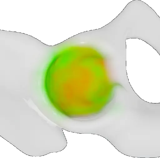 Density distribution in the acetabulum