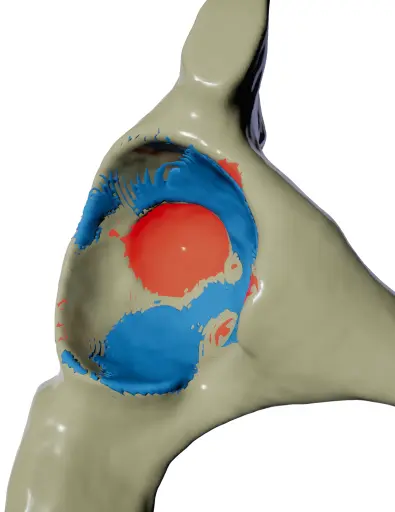 Over-reamed material in red